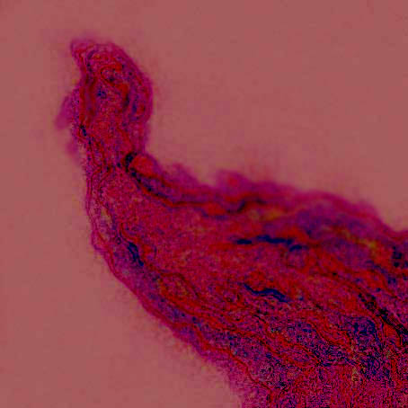 sick000.jpg (33758 �ֽ�)